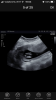 823596BC-FB40-4E81-80D4-8B8FE7F1BD3B.png