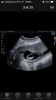 C5C80707-4ABC-449C-9D5C-3C7ECF539359.png