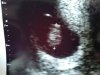 IMG_20190214_103918.jpg