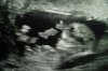 20190215_053452.jpg