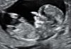 DDDEE20E-0633-4CBE-888F-C610B5301378.jpeg