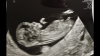 A86C7581-518E-4B37-B9AD-ABF0E0FD4DCF.png
