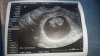 IMG-20190225-WA0000.jpeg