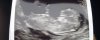 89010A18-613E-4BAD-B4E6-D3E2210A3F04.jpeg