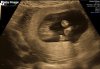 0AFF1186-9874-478D-BEBE-A5CC5910CD25.jpeg