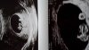 IMG-20190304-WA0001.jpeg