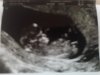 thumbnail_20190305_215918.jpg