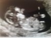 thumbnail_20190305_215904.jpg