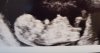 20190306_160140.jpg