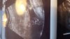 IMG-20190307-WA0006.jpeg