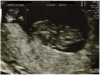 8.5 Week ano.jpg