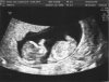 Baby Leetz 12 weken 034.jpg
