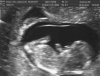 Baby Leetz 12 weken 033.jpg