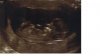 echo 11w6d.jpg