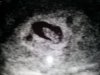 20130124_141637.jpg