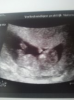 baby van elfje 82.png