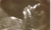 echo 12w5d.jpg