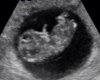 Echo 2012-10-29.jpg