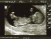 baby Kneefel 2 .1.jpg