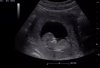 upload_2019-3-14_23-6-8.jpeg