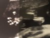 4FD6DEB2-ECB9-4285-A4CF-D9DC7917B33C.jpeg