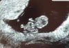 B1785AFD-0A10-441D-8617-2DAD6115A27D.jpeg