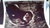 IMG-20190322-WA0006.jpeg