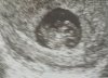 20190401_103604-1.jpg