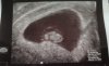 baby 02.04.2019.jpg
