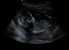 snip_20190406191241.png