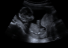 snip_20190406191327.png