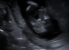 snip_20190406191345.png