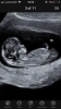 0D436D49-C5C7-46DC-B261-84F8B3DB067A.png