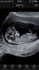 5254F726-0BFD-4DEF-8F93-8E184FD6581A.png