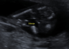 snip_20190408211351.png