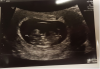 upload_2019-4-11_21-16-49.png