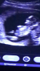670BFAE3-57AE-4EF9-AE31-F225BF39DDE0.png