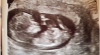 upload_2019-4-24_14-42-24.png