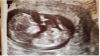 upload_2019-4-24_14-43-49.png