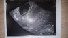 IMG-20190425-WA0005.jpeg