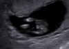 upload_2019-5-1_14-56-1.png