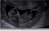 upload_2019-5-1_14-58-46.png