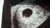 IMG-20190503-WA0001.jpeg