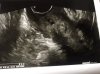 2CD1B842-D399-45C7-A0ED-1DFFE31E8CF5.jpeg