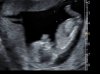 Aantekening 2019-05-07 102735.jpg