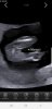 Screenshot_20190525-144424_Hello Mom.jpg