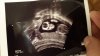 IMG-20190527-WA0013.jpeg
