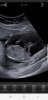 Screenshot_20190528-141624_Hello Mom.jpg