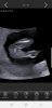 Screenshot_20190528-141637_Hello Mom.jpg