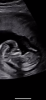 6F3D4C5F-0BE4-4235-B51C-93721D8E4EB2.png